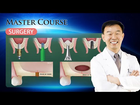 [Master Course - SURGERY] CAS Technique