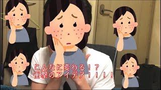 【女子必見】身近な意外な物で肌荒れは治る⁉