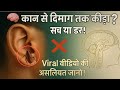 कान में कीड़ा घुस जाए तो क्या होगा सच्�