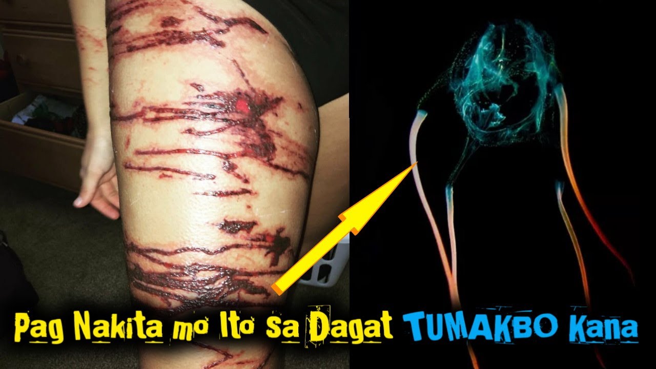 10 dilikadong hayop sa Dagat ng pilipinas | 10 DANGEROUS SEA CREATURES FOUND IN PHILIPPINES 🇵🇭