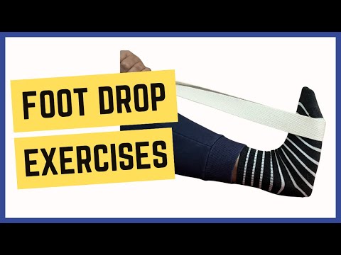 Exercises for Foot Drop After Stroke