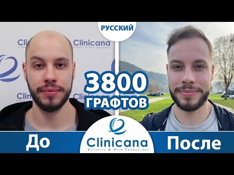 vid