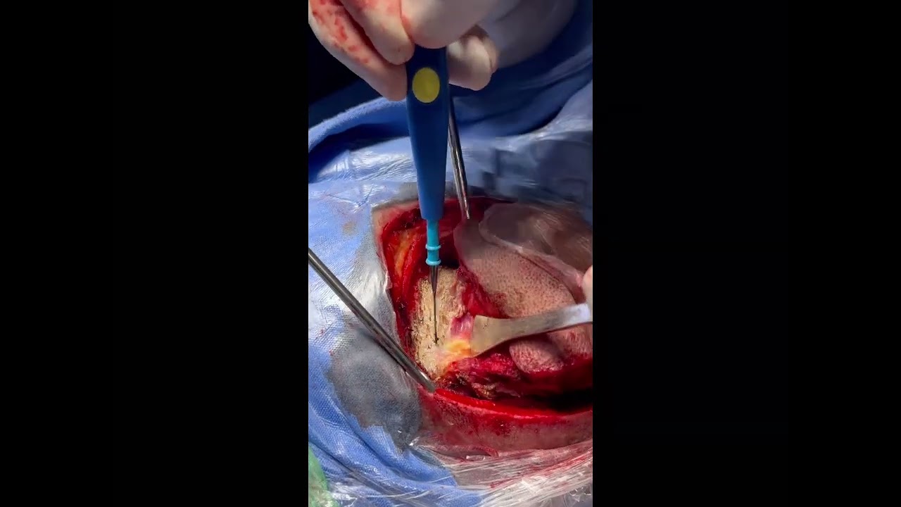 Luis Alfonso Castillejo Adalid-4