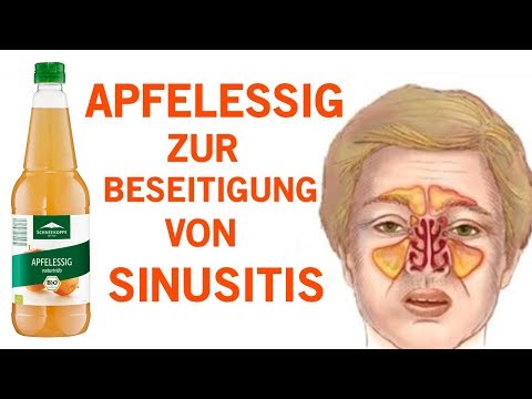 , title : 'Wie du eine Sinusitis innerhalb von Minuten mit Apfelessig los wirst!'