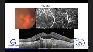 Download Lagu AIOS ARC Enhancing Concepts OCT u0026 OCT... Dr A GIRIDHAR Thumbnail