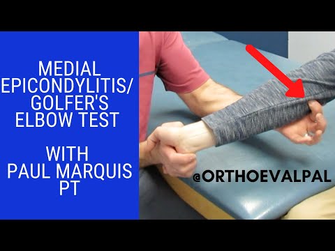 Hook Test For Distal Biceps Rupture