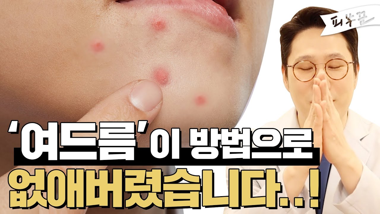 related_video_thumbnail