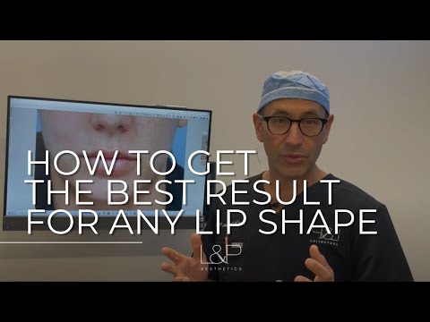 Lip Lift, Corner Lip Lift in Palo Alto - Bay Area Plastic Surgeon - Tips For Best Lip Shape Results