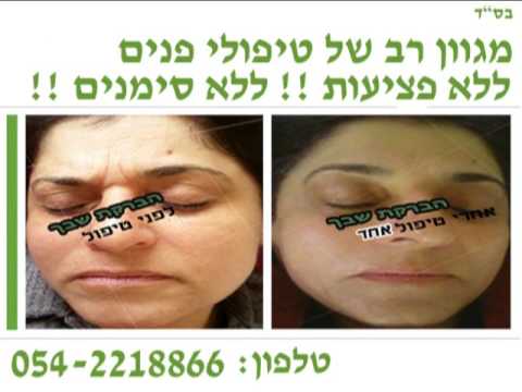 תמונה של البركت شافك