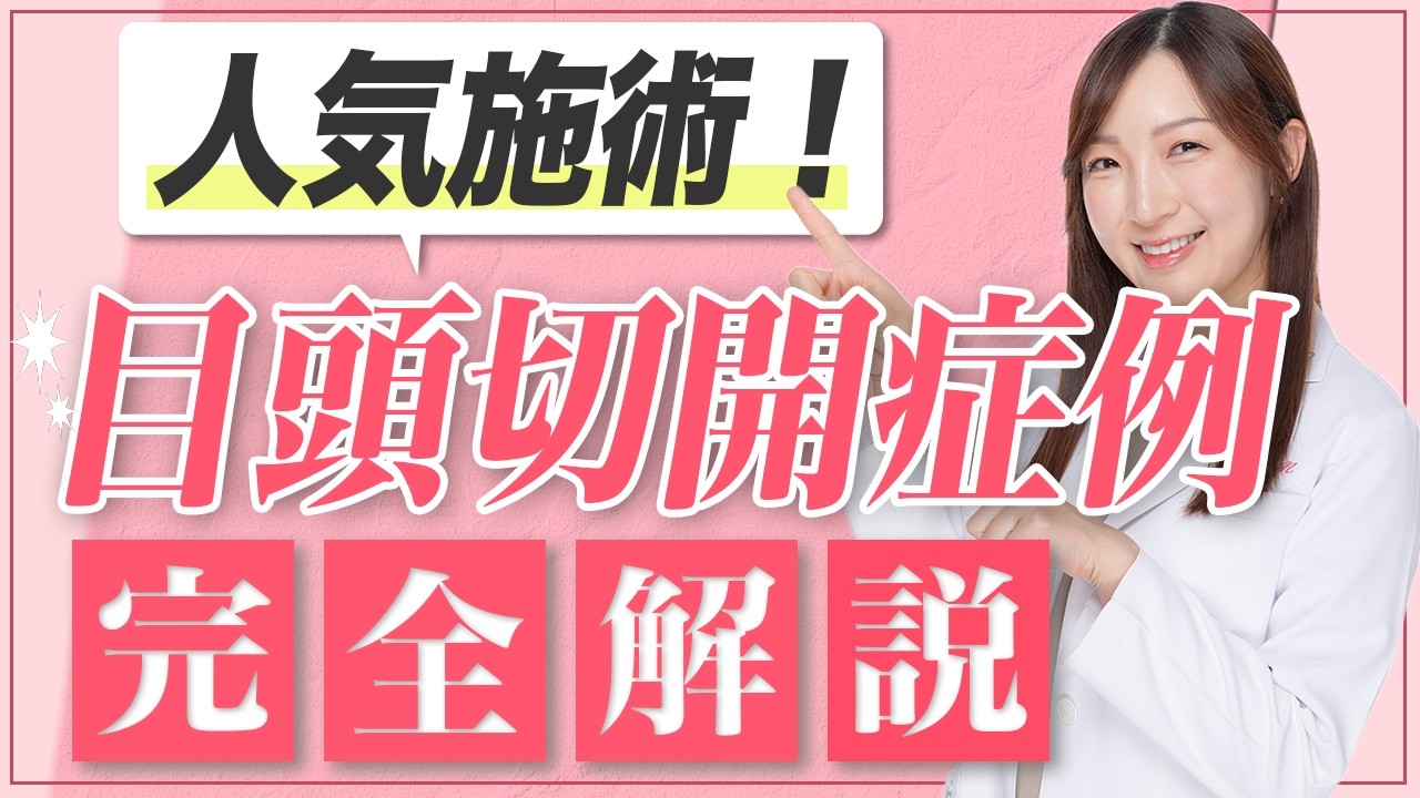目頭切開を迷っているなら、ぜひこれを見て❗️【目頭切開 総集編】