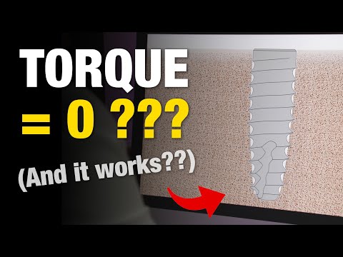 Insertion torque is a TERRIBLE metric for judging primary stability