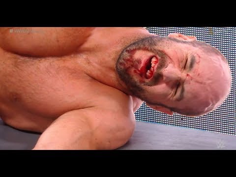 Cesaro loses his teeths HD -  No Mercy 2017