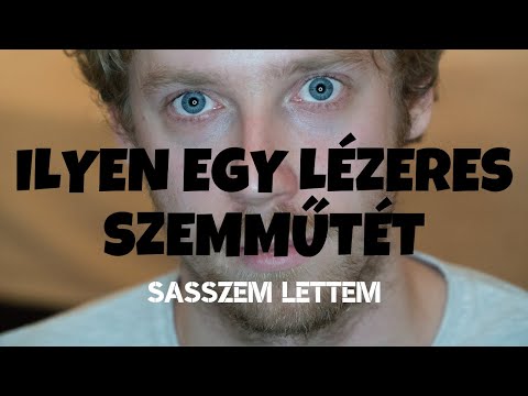szóda és látás videó
