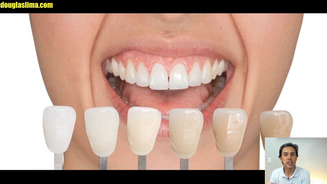 COMO O DENTISTA MEDE A COR DOS DENTES