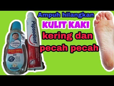 download lagu mp3 mp4 Cara Alami Untuk Kulit Kaki Kering, download lagu Cara Alami Untuk Kulit Kaki Kering gratis, unduh video klip Cara Alami Untuk Kulit Kaki Kering