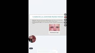 Viral infections   Etiology, Clinical features, Diagnosis and Treatment