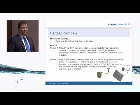 Sequana Medical Live Stream