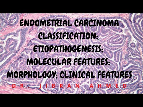 ENDOMETRIAL CARCINOMA II FEMALE GENITAL TRACT II ROBBINS 10TH E II PATHOLOGY LECTURE