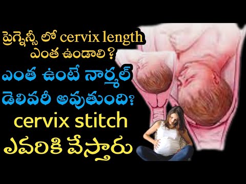 what is the normal cervix length during pregnancy | cervix length during pregnancy chart in telug