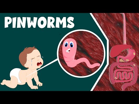 Pinworm- Infection, Causes and Treatment | Life Cycle of Pinworm | Video for Kids
