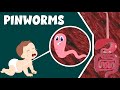 Pinworm- Infection, Causes and Treatment | Life Cycle of Pinworm | Video for Kids