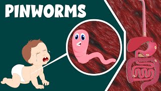 Pinworm- Infection, Causes and Treatment | Life Cycle of Pinworm | Video for Kids