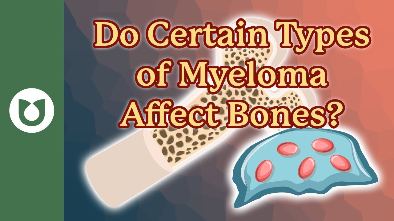 Do certain types of myeloma affect your bones more than others? #myeloma