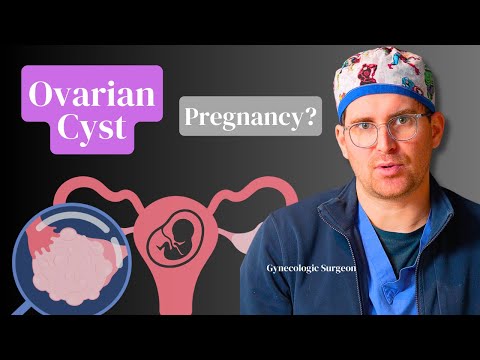 OBGYN Discusses: Ovarian Cysts and Pregnancy