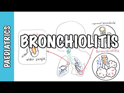 Neonatal Infections Overview
