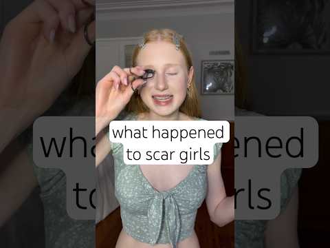 Was scar girls scratch real ?!