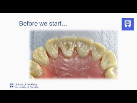 Endodontic treatment of the single rooted tooth. Part 2: Access cavity preparation