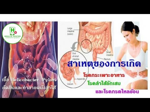Tsinokap ของโรคสะเก็ดเงินตามความคิดเห็นของหัว ที่ pricked โดยโรคสะเก็ดเงิน flosteron