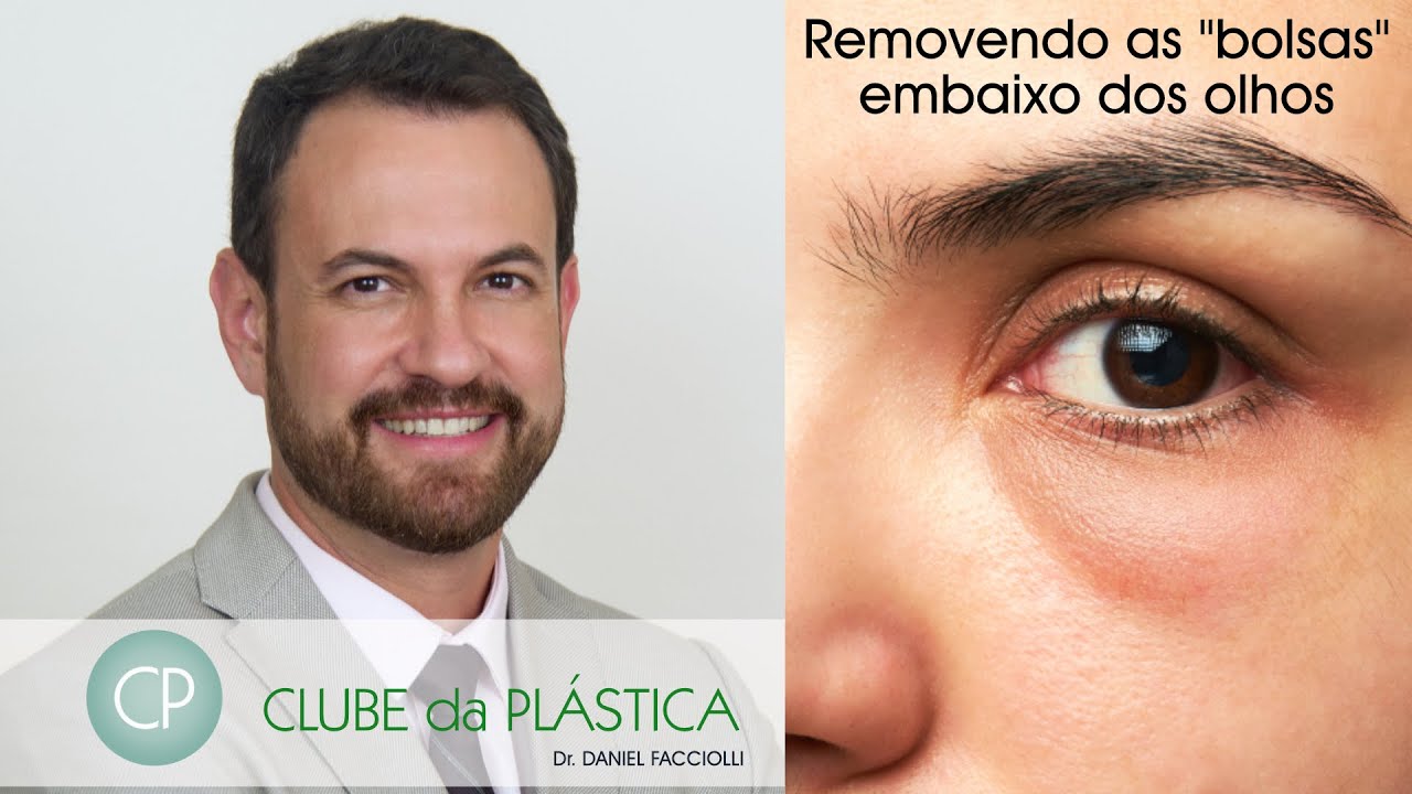 Removendo as bolsas embaixo dos olhos