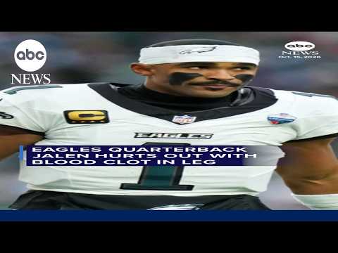 Eagles quarterback Jalen Hurts out with blood clot in leg
