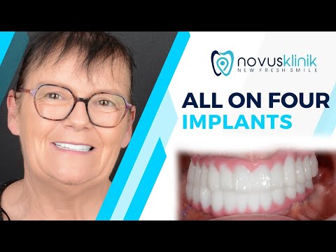Logo of A Patient’s Experience – Full Mouth Zirconium Dental Implants Abroad in Istanbul, Turkey