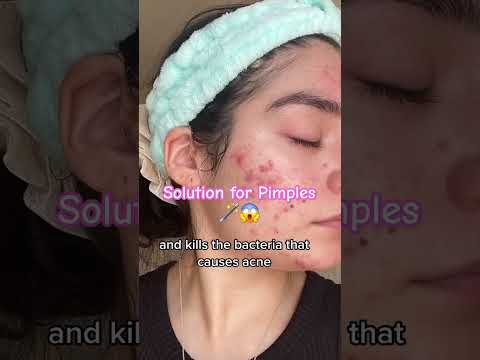 get rid of acne fast with high frequency wand #highfrequency #skin #skincare