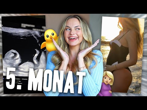 Ich bin SCHWANGER! Eure Fragen | XLAETA