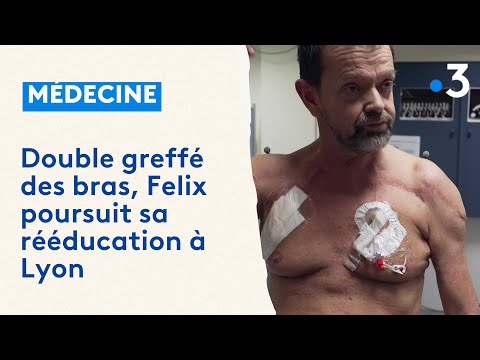 Felix Gretarsson, double greffé des bras, 3 ans après son opération