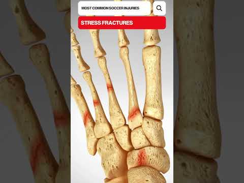 Guess The Spine Injury And Procedure Challenge
