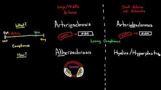 Arteriosclerosis, Arteriolosclerosis, and Atherosclerosis