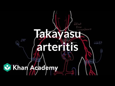 Takayasu arteritis | Circulatory System and Disease | NCLEX-RN | Khan Academy