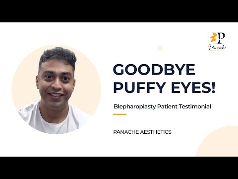 Blepharoplasty Testimonial