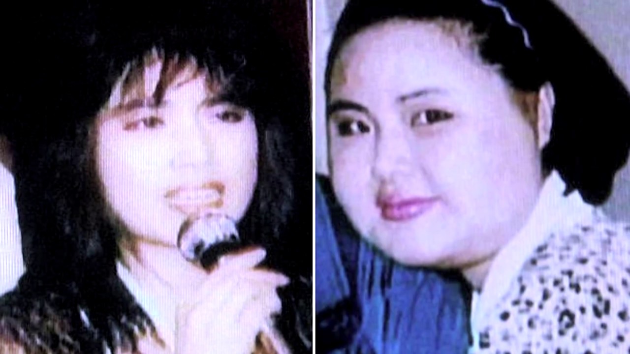 Top 10 Cirugías estéticas que TERMINARON TERRIBLEMENTE MAL!!