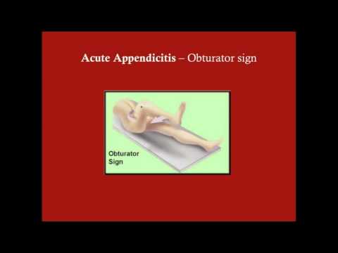 Acute Appendicitis - CRASH! Medical Review Series