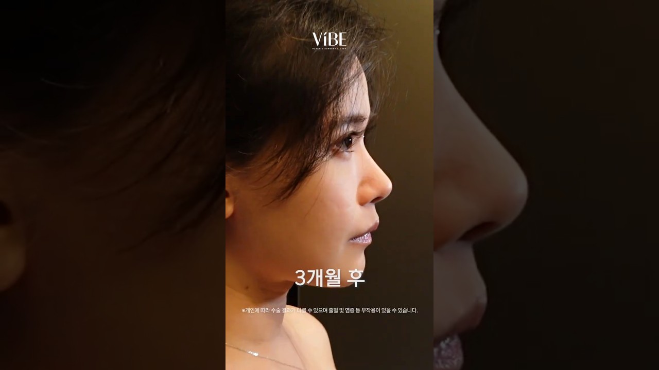 보기만 해도.. 설명이 필요없는 눈코성형 전후비교🫢✨