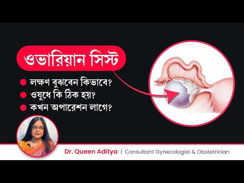 ওভারিতে সিস্ট হলে কি সমস্যা হয়? ওষুধে ঠিক হয় নাকি অপারেশন লাগে? Ovarian Cyst Symptoms & Treatment
