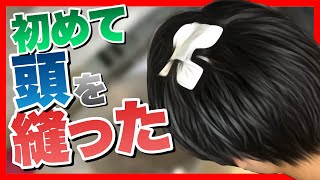 頭から大出血...初めて○針縫いました