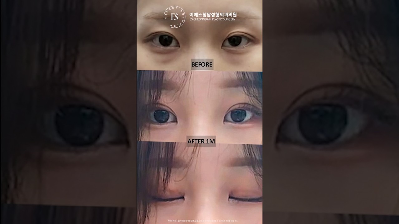 이에스 유튜브