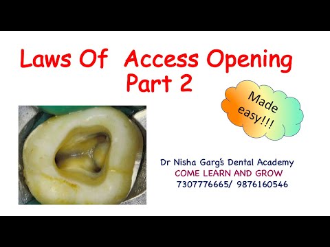 Laws Of Access Cavity Preparation - Part 2