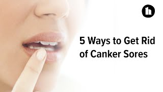 5 Ways to Get Rid of Canker Sores | Healthline